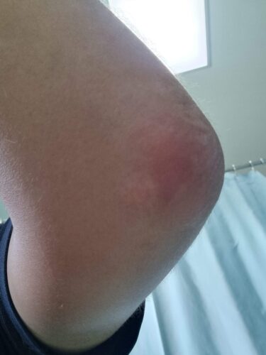 Natürliche Farbe würde ich sagen.